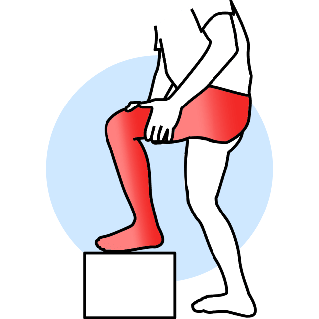 Sciatica illustration